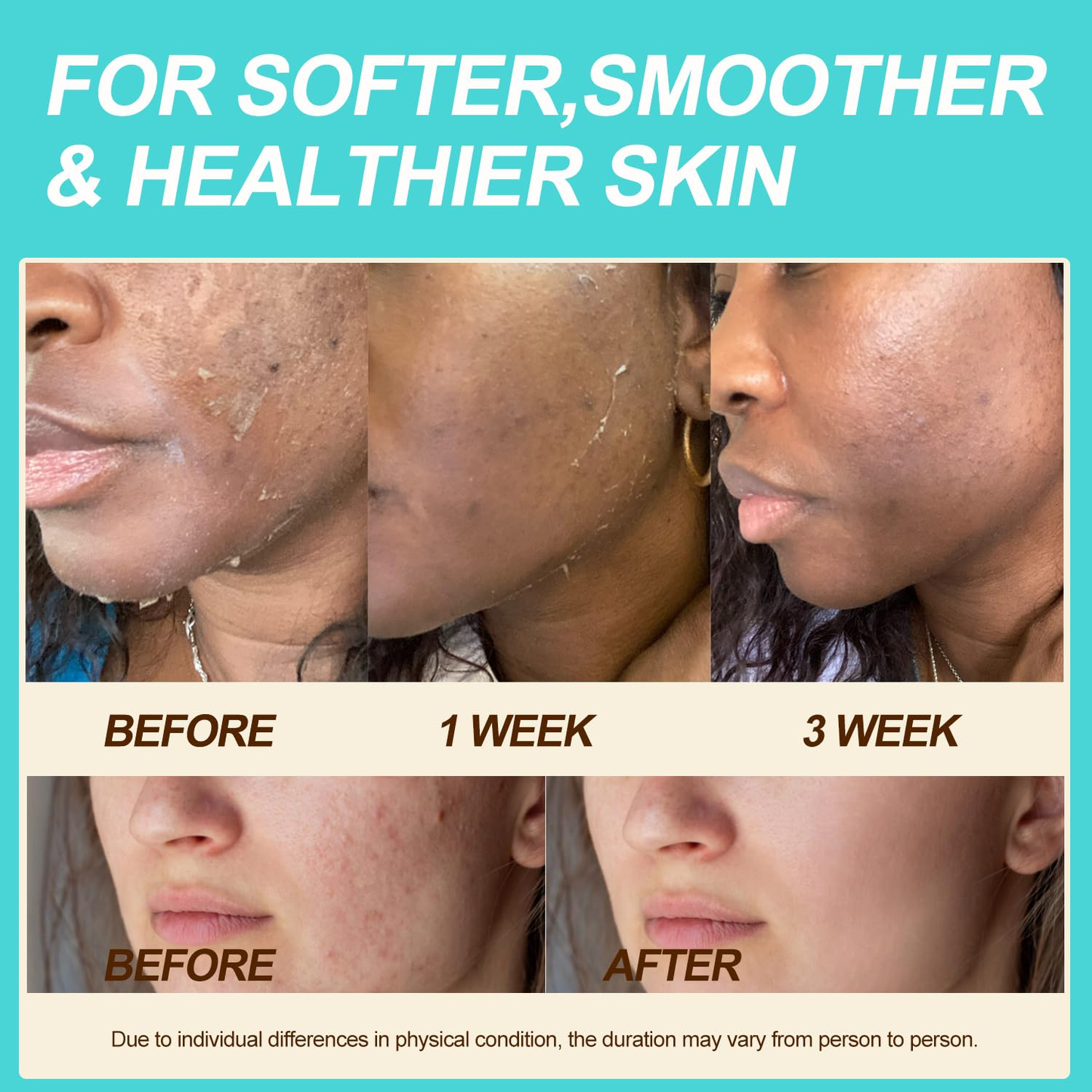 Beef Tallow & Honey Balm | Grass Fed Moisturizing Cream for Face & Body