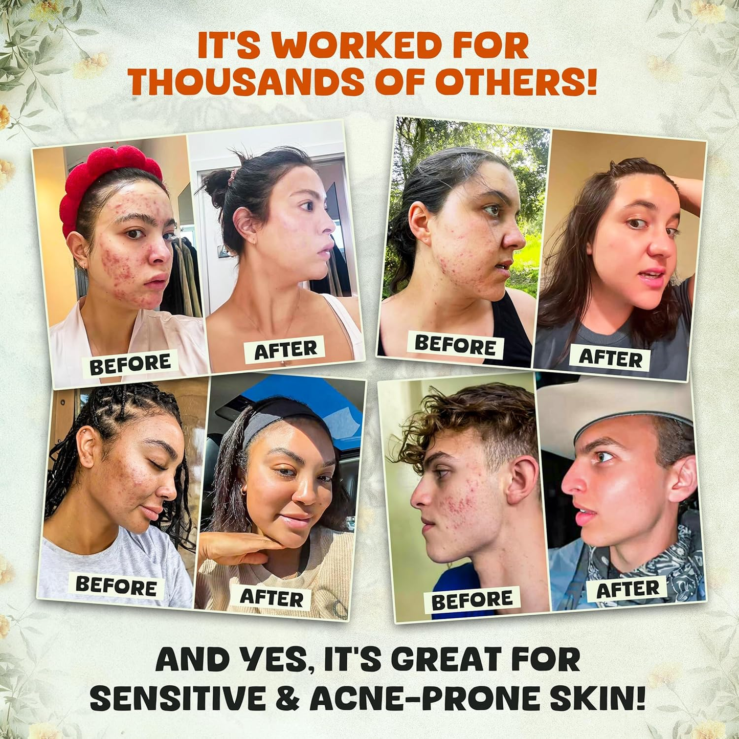 Beef Tallow & Honey Balm | Natural Face, Body & Lip Moisturizer | Unscented / Citrus Scented | Non-Toxic